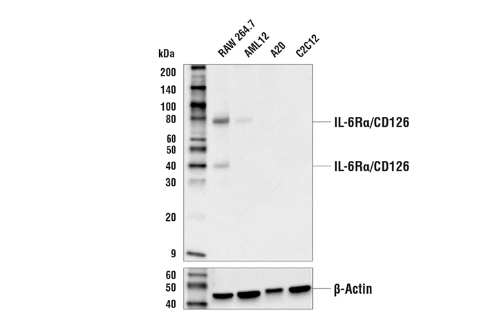 IL-6Rα/CD126 (E7H4J) Rabbit mAb