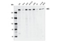 Acetyl-CoA Carboxylase Antibody