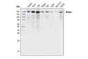 mTOR Pathway Antibody Sampler Kit