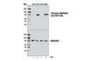 Phospho-MARCKS (Ser167/170) (D13E4) XP Rabbit mAb