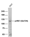 磷酸化IRE1蛋白抗体