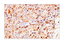 SignalStain Boost IHC Detection Reagent (HRP Rat)